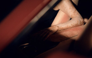 mycar Tyre & Auto creates the world's first "Sunburnt Car", showing driver's sun safety "Blindspot" to UV Exposure Behind the Wheel