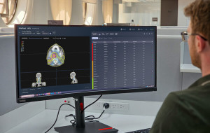 GenesisCare and SeeTreat to bring personalised Offline Adaptive Monitoring to more than 40 radiation oncology centres across Australia