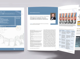 Image: Professor Gang Shen's Orthodontic Team Publishes Third Consecutive Paper in the Journal of Aligner Orthodontics
