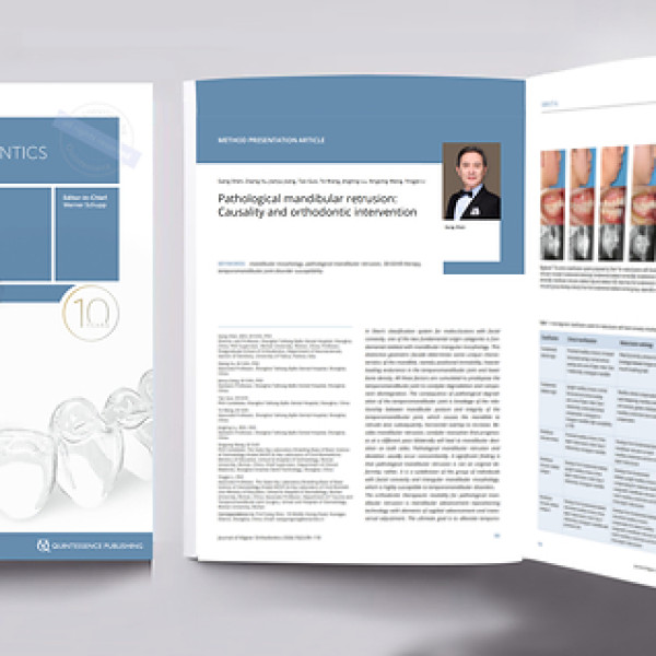 Image: Professor Gang Shen's Orthodontic Team Publishes Third Consecutive Paper in the Journal of Aligner Orthodontics