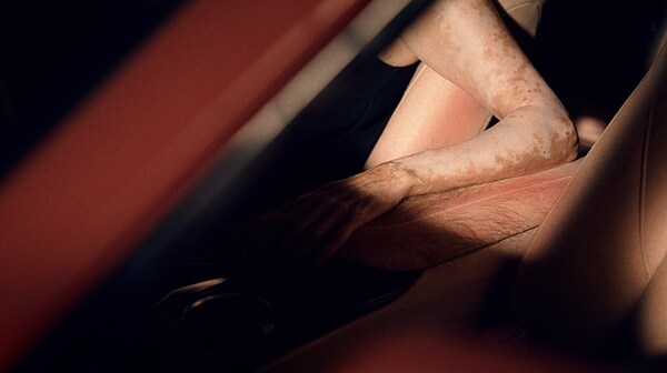 mycar Tyre & Auto creates the world's first "Sunburnt Car", showing driver's sun safety "Blindspot" to UV Exposure Behind the Wheel