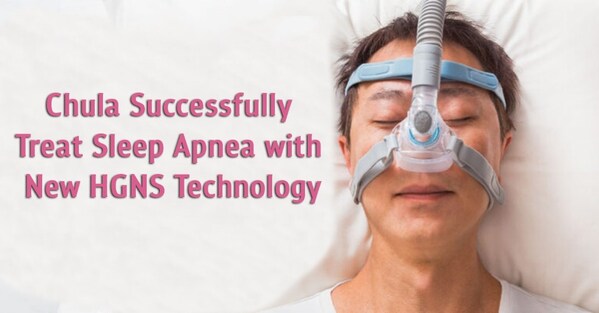 Chulalongkorn University doctors successfully performed surgery for obstructive sleep apnea using the new HGNS technique the fourth successful surgery of this kind in Asia
