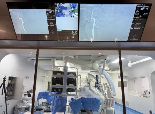 PANVIS STAR Vascular Interventional Robotic System Redefines Mechanical Thrombectomy