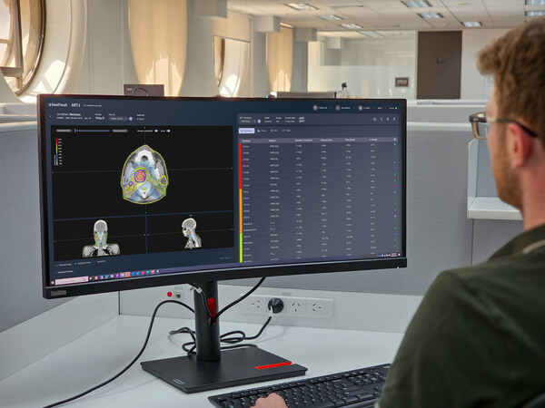 GenesisCare and SeeTreat to bring personalised Offline Adaptive Monitoring to more than 40 radiation oncology centres across Australia